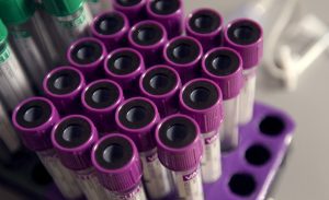 Top 10 Forensic Compounds/Topics of 2016 – The Analysis of Δ9-THC and Its Main Metabolites in Whole Blood